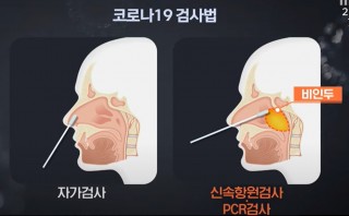 자가검사키트 먼저 사용..동네병원서 신속항원검사